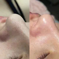 تجربه فیشال لوکس و تخصصی با بهترین های دنیا|خدمات آرایشگری و زیبایی|محمدشهر, محمدشهر|دیوار