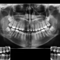 خواستار کار در رادیولوژی و عکس برداری وفیزیوتراپی