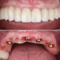 جشنواره خدمات دندانپزشکی با اقساط ۱۵ ماهه + وام|خدمات آرایشگری و زیبایی|تبریز, |دیوار