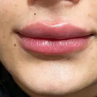 کاشت مو/لیزر مـو زائد/لاغری/فیلر بادی/ نخ و بوتاکس|خدمات آرایشگری و زیبایی|شیراز, گل سرخ|دیوار