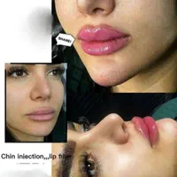 جشنواره تزریق ژل و بوتاکس و آموزش|خدمات آرایشگری و زیبایی|اصفهان, بهار آزادی|دیوار