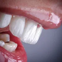 کامپوزیت دندان اقساطی ،بدون چک و ضامن|خدمات زیبایی و سلامت|تهران, جردن|دیوار