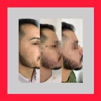 ریش امضایی صورت ی مرده ...