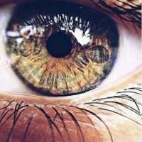 عمل چشم لازک با تعرفه ۱۴۰۴