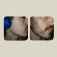 20روزه|آرایشی، بهداشتی، درمانی|بیرجند, |دیوار