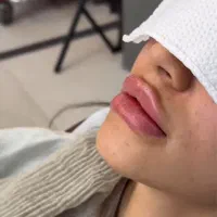 اجاره لاین در کلینیک زیبایی تحت نظر پزشک