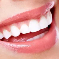 ایمپلنت سوئیس + مگاژن کره‌ای15/900با روکش