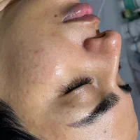 فیشال و پاکسازی صورت|خدمات آرایشگری و زیبایی|شیراز, شهرک فرزانگان|دیوار