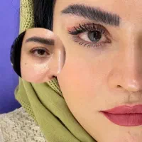 بلفاروپلاستی پلک ساکشن غبغب اتوپلاستی سانترال لب در شیراز، معالی‌آباد، بلوار دکتر شریعتی