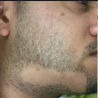 چرا ریش بعضی مردها هیچ‌وقت پرپشت نمی‌شود