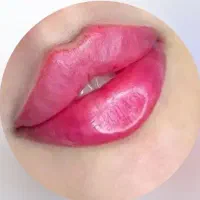 تزریق ژل‌فیلر،لب،گونه‌(جشنواره یلدا)درمطب فقط499ت