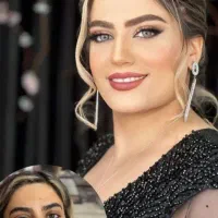 تخفیف بی‌نظیرکاشت ناخون.فقط ۳۶۰تمن. طلاب