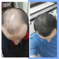موهاتو جنگل کن