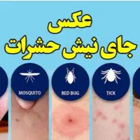 سمپاشی عقرب|خدمات نظافت|کیش, |دیوار