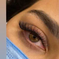 کاشت مژه ۲۸۰