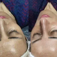 بمب تخفیفات فیشال و خدمات پوستی شروع قیمت از ۱۸۸|خدمات آرایشگری و زیبایی|شیراز, فرگاز|دیوار