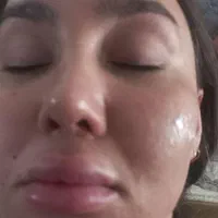 جوانساز پوست|خدمات آرایشگری و زیبایی|کرج, شهرک ظفر|دیوار