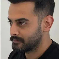 کاشت مو طبیعی/میگروگرافت/ مشاوره رایگان