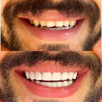 دندانپزشکی توحید.کاپوزیت،لمینت، ایمپلنت|خدمات آرایشگری و زیبایی|شیراز, فرگاز|دیوار