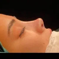 با ماهی ۵ میلیون بینی عمل کن|خدمات آرایشگری و زیبایی|تهران, سهروردی|دیوار