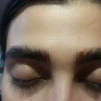 کراتین،پروتیینه،کاشت مژه