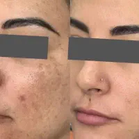 با بیوممتیک لک هات رفتنی