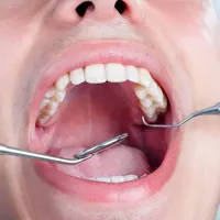 خدمات دندانپزشکی با کیفیت|خدمات آرایشگری و زیبایی|رشت, استادسرا|دیوار