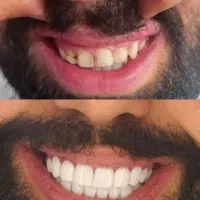 ،خدمات زیبایی ، ب مدل کامپوزیت نیازمندیم