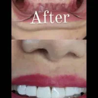 دندانپزشکی با بهترین متریال و مواد درجه یک|خدمات آرایشگری و زیبایی|کرمانشاه, |دیوار