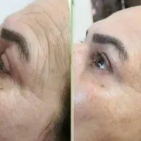 سلامتی و زیبایی دائمی