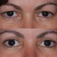 دیگه نیاز به عمل و جراحی نیست|آرایشی، بهداشتی، درمانی|نیشابور, جمهوری|دیوار