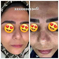 میخای پوستت مثل آیینه شفاف بشه