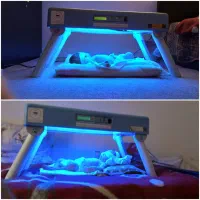 دستگاه زردی