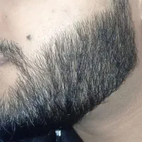 پـرپـشـتی ریش