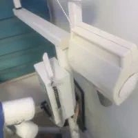 رادیوگرافی دندانپزشکی فریکس دو شکن