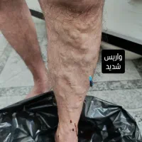 طب سنتی|خدمات آرایشگری و زیبایی|نورآباد, |دیوار