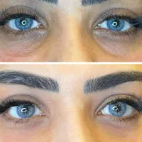 فیلرلب مادلینگ جوانسازی بوتاکس فیلرزیرچشم فیلربادی|خدمات آرایشگری و زیبایی|تهران, سید خندان (جلفا)|دیوار