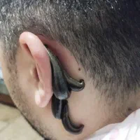 زالودرمانی از تولید به مصرف شلکا