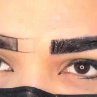 کلینیک کاشت مو و زیبایی شایلین