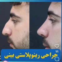 جشنواره عمل بینی جراحی بینی با ده تومن پیش|خدمات آرایشگری و زیبایی|تهران, فلسطین (میدان انقلاب)|دیوار