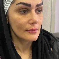 کاشت ابروی مادام العمر در کلینیک تخصصی پوست و مو|خدمات آرایشگری و زیبایی|فولادشهر, C5|دیوار