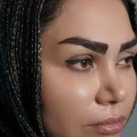 کاشت ابرو به روش تخصصی میکرو‌پلاس