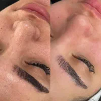 پاکسازی و فیشال پوست