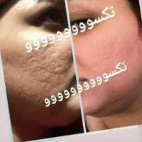 پاکسازی کبد و اصلاح مزاج لاغری پوست مو چاقی صورت|آرایشی، بهداشتی، درمانی|فردیس, شهرک ۱۱۰|دیوار