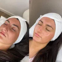 فشیال تخصص پوست|خدمات آرایشگری و زیبایی|شیراز, بعثت|دیوار