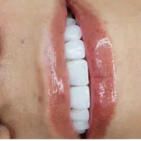 دستیار دندانپزشک