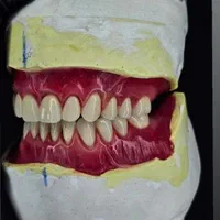 اولین و تنها مرکز دندانسازی بدون لقی در لردگان