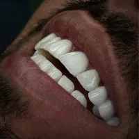 مجموعه فوق تخصصی دندان در پردیس