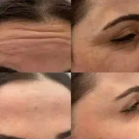 کرم بیوممتیک چند کاره اصل