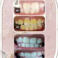 سفیدی دندان تا بوی خوش دهان|آرایشی، بهداشتی، درمانی|تهران, شهید رجایی|دیوار